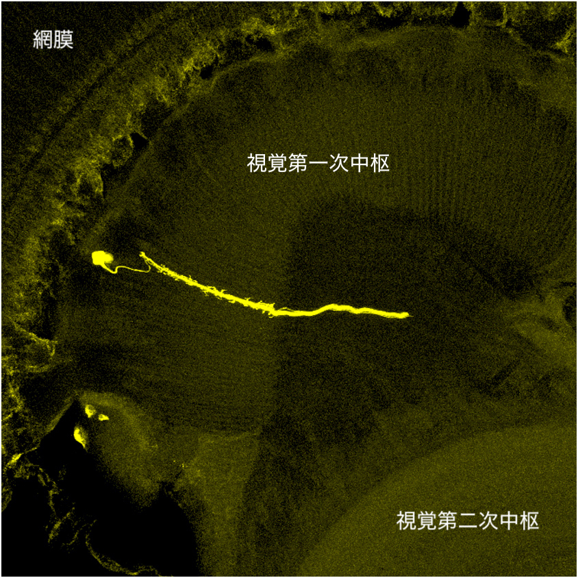 共焦点レーザースキャン顕微鏡