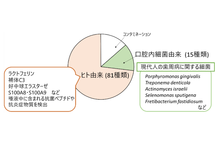 歯石から読み解く歯周病原因子